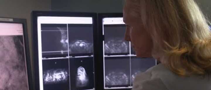 Embedded thumbnail for What to Expect When Having a Mammogram