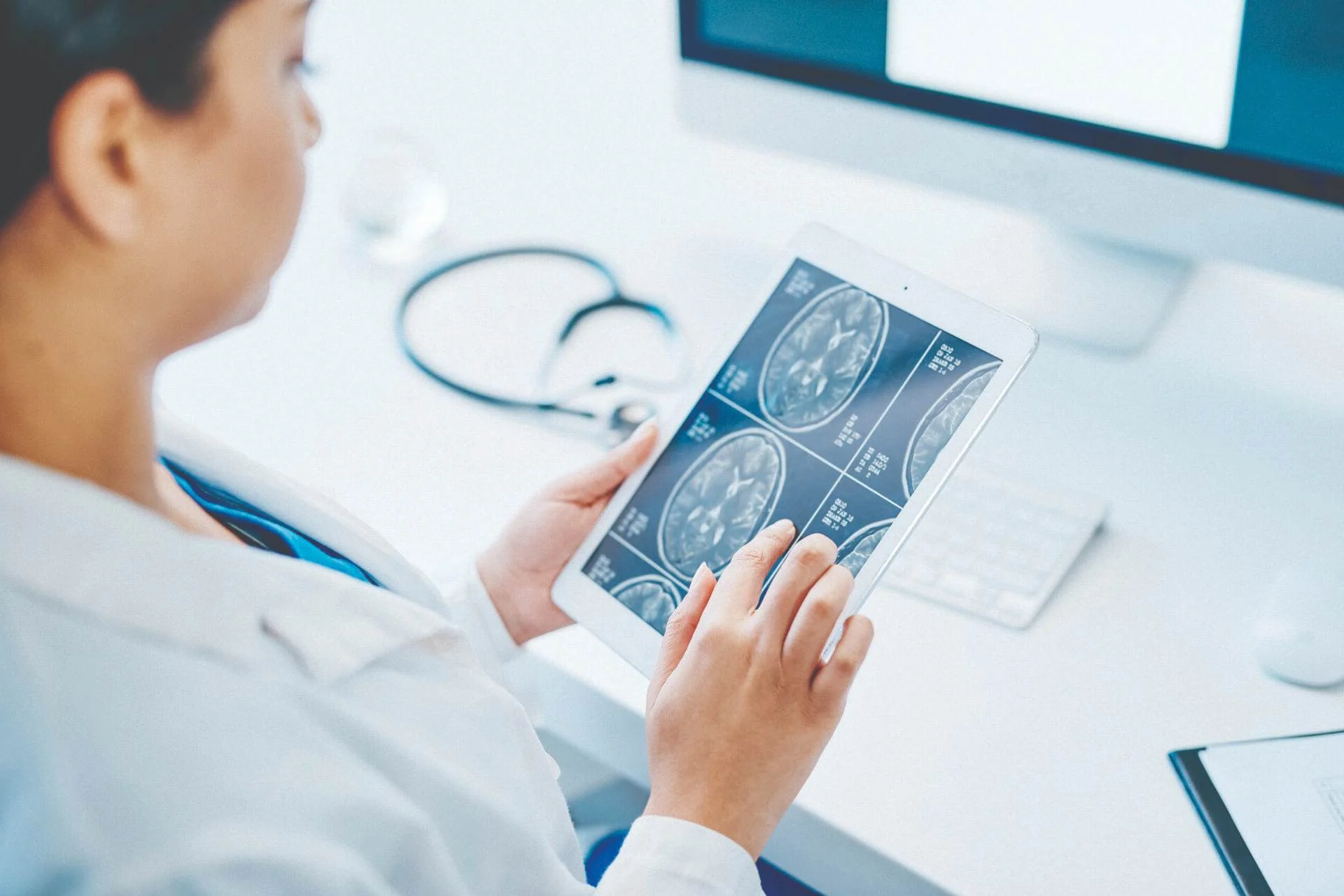 doctor reviews mri of brain