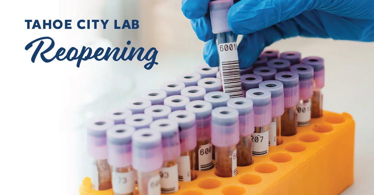 lab vials