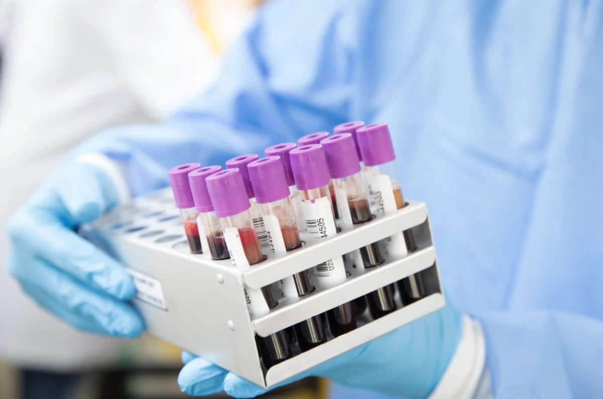 bloodtest gloved hands holding vials for testing