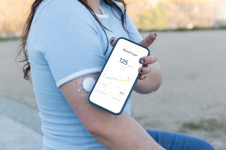 Woman monitoring blood sugar with cgm and health app Woman monitoring blood sugar with continuous glucose monitor and health app